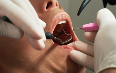 Do Dental Implants Hurt? Understanding the Procedure